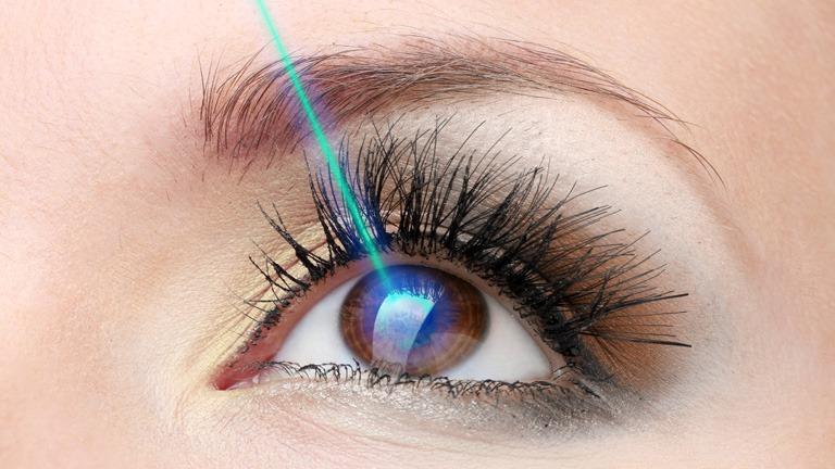 Augen lasern – alles Wichtige rund um den Eingriff