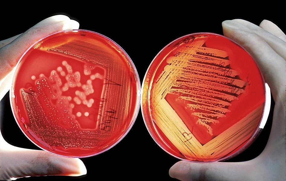 Bakterielle Infektionen – Arten und Behandlungen