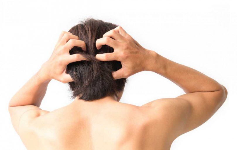 Juckende Kopfhaut, Haarausfall – richtig behandeln!