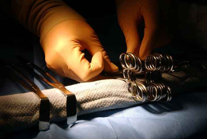 Vasektomie Ablauf – Vorbereitung und mögliche Komplikationen