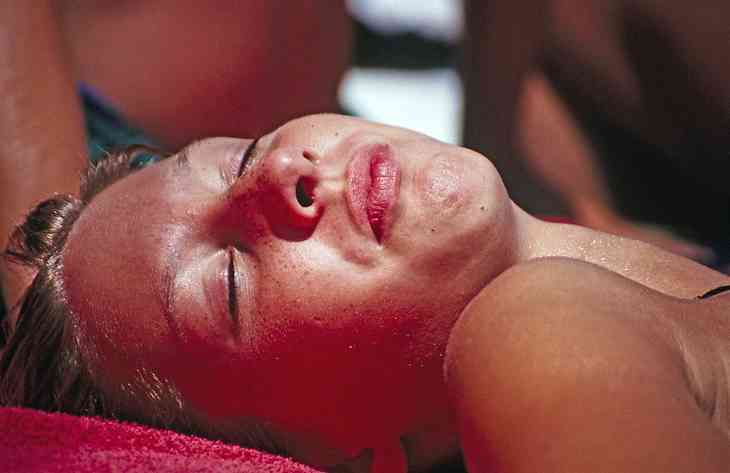Was tun bei Sonnenbrand? – Natürliche Heilmittel helfen!