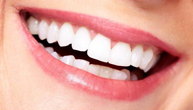 Zähne aufhellen und bleichen: Tipps und Tricks!